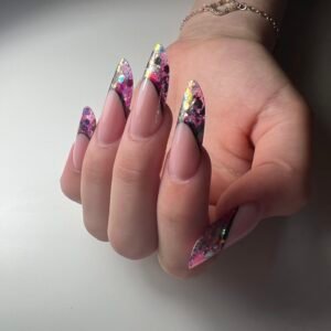 French Inlay (foto westrijd)